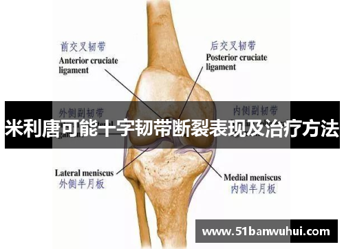 米利唐可能十字韧带断裂表现及治疗方法